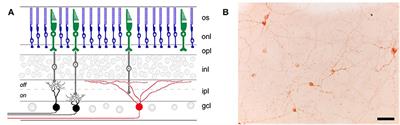 Chromatic Pupillometry Methods for Assessing Photoreceptor Health in Retinal and Optic Nerve Diseases